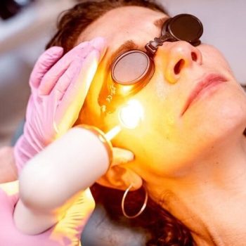 laser amarelo